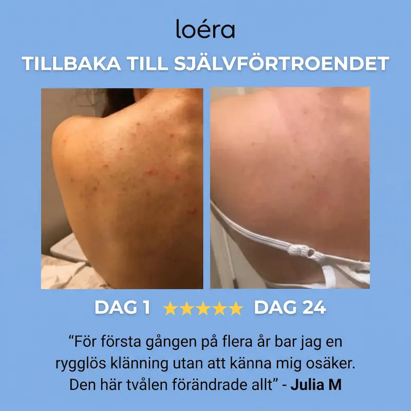 Loéra™ Kroppstvål mot akne