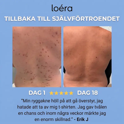 Loéra™ Kroppstvål mot akne